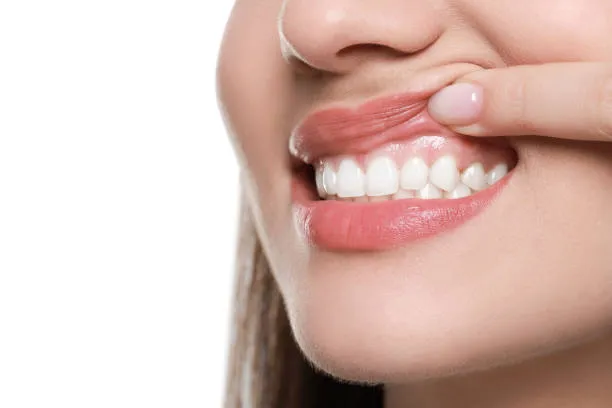Perio Protect gum disease treatment at SmileKraft Dental in Jersey City
