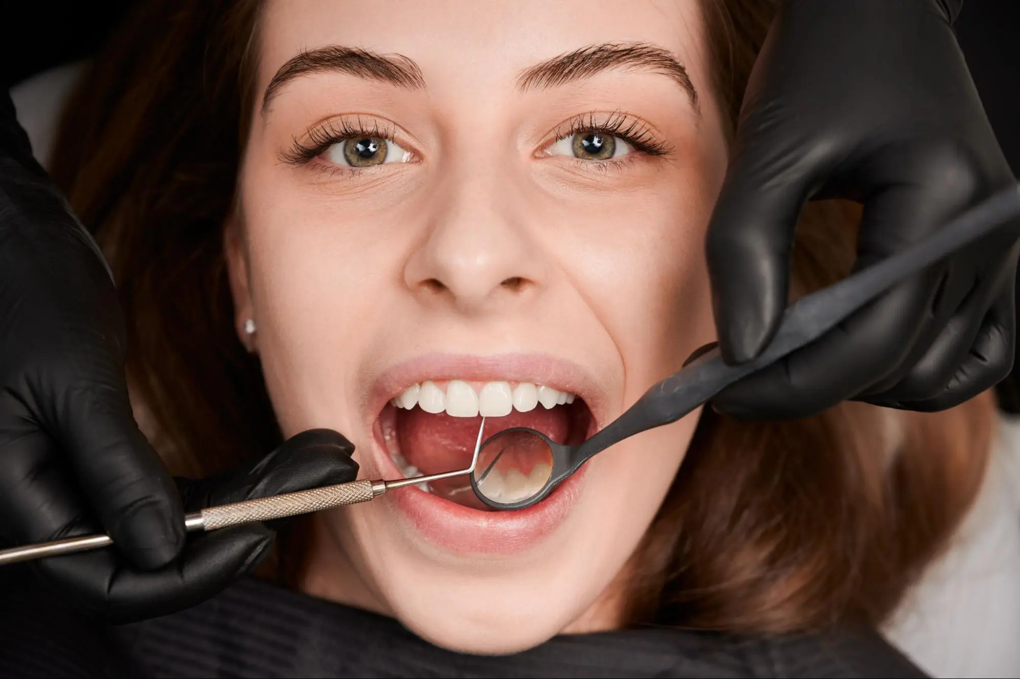 Root Canal Treatment