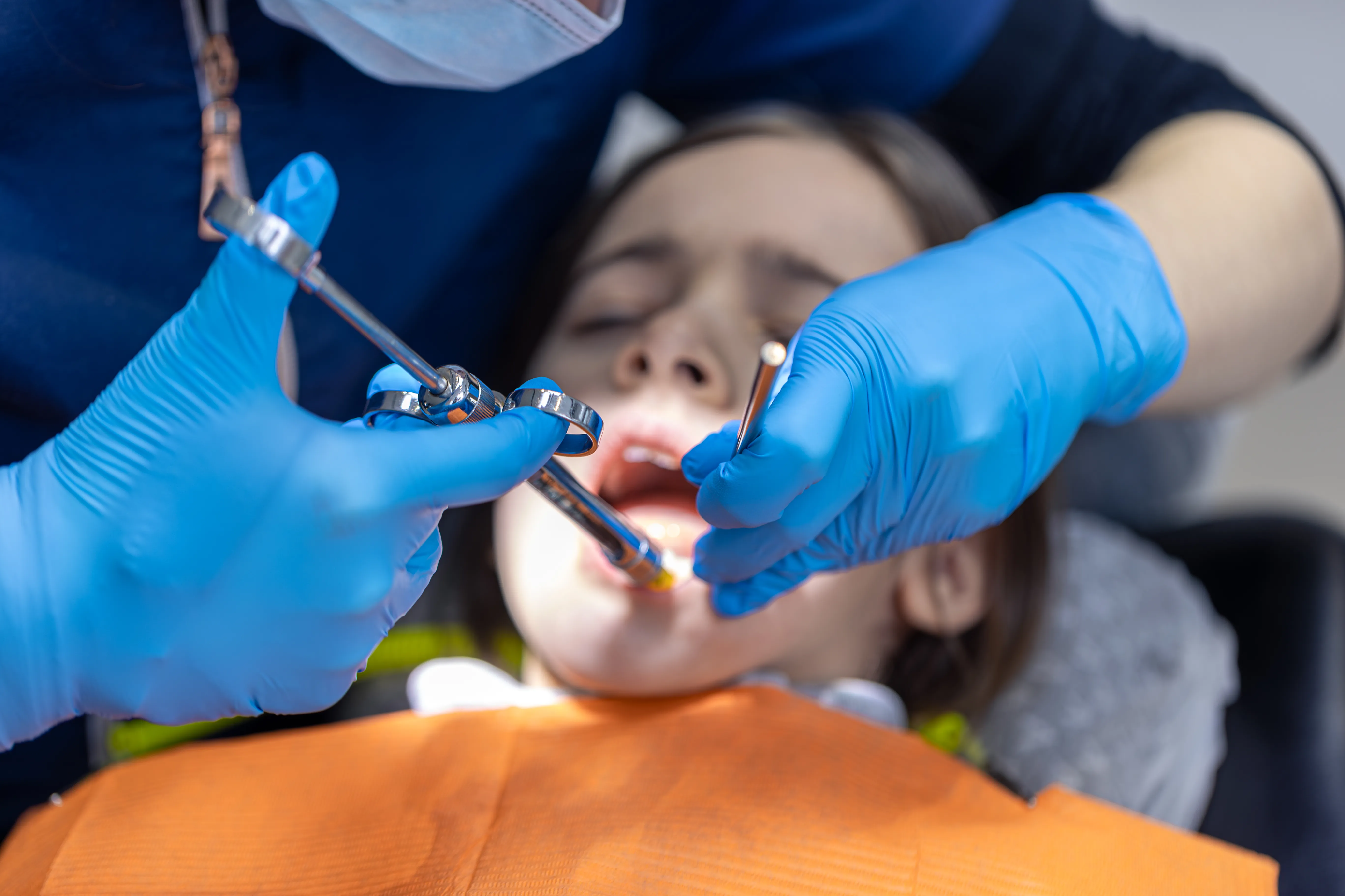 Tooth extractions at SmileKraft Dental in Jersey City
