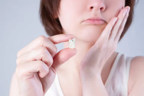 Wisdom Teeth Removal at SmileKraft Dental in Jersey City