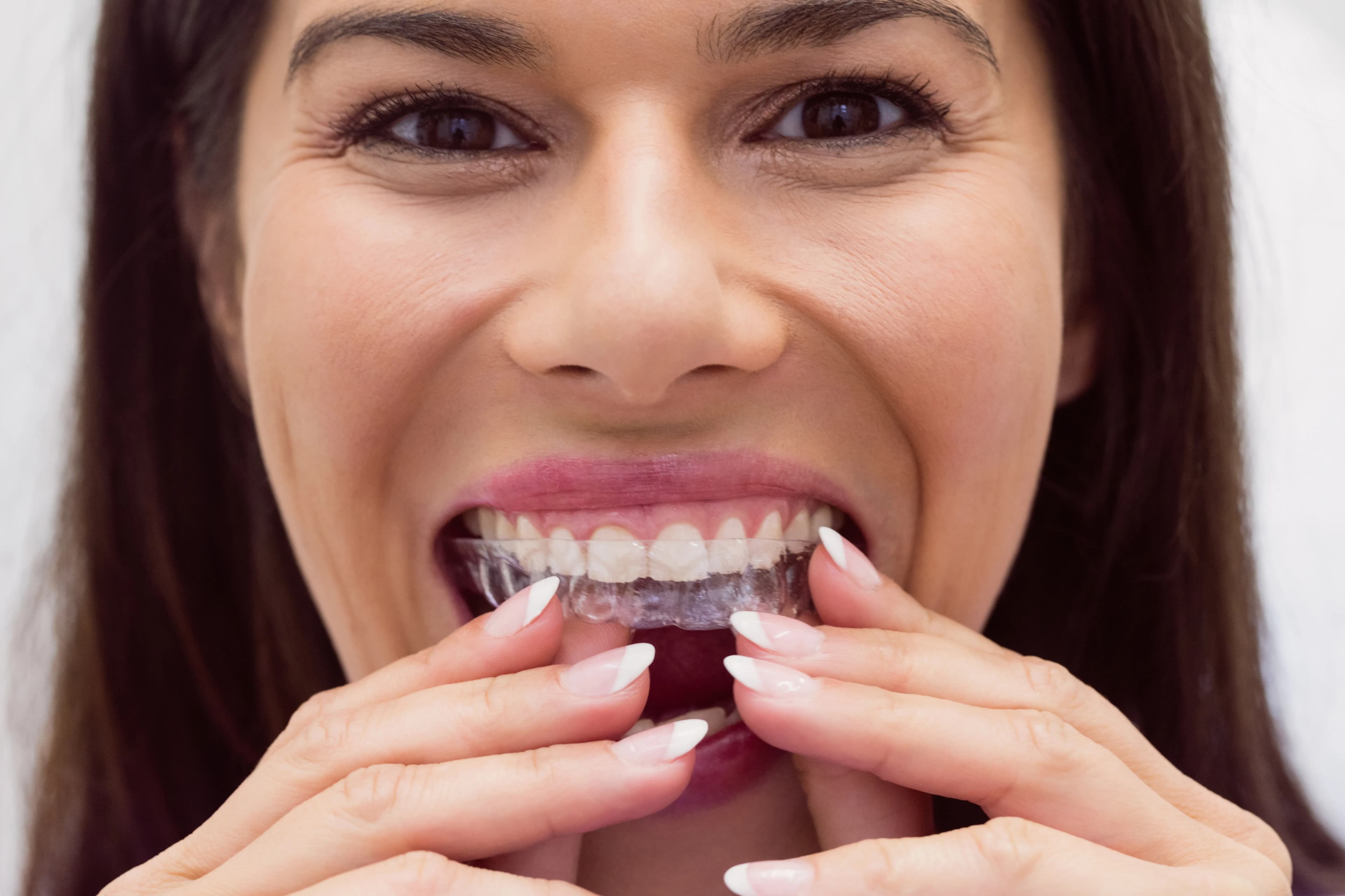 Invisalign treatment at SmileKraft Dental Jersey City