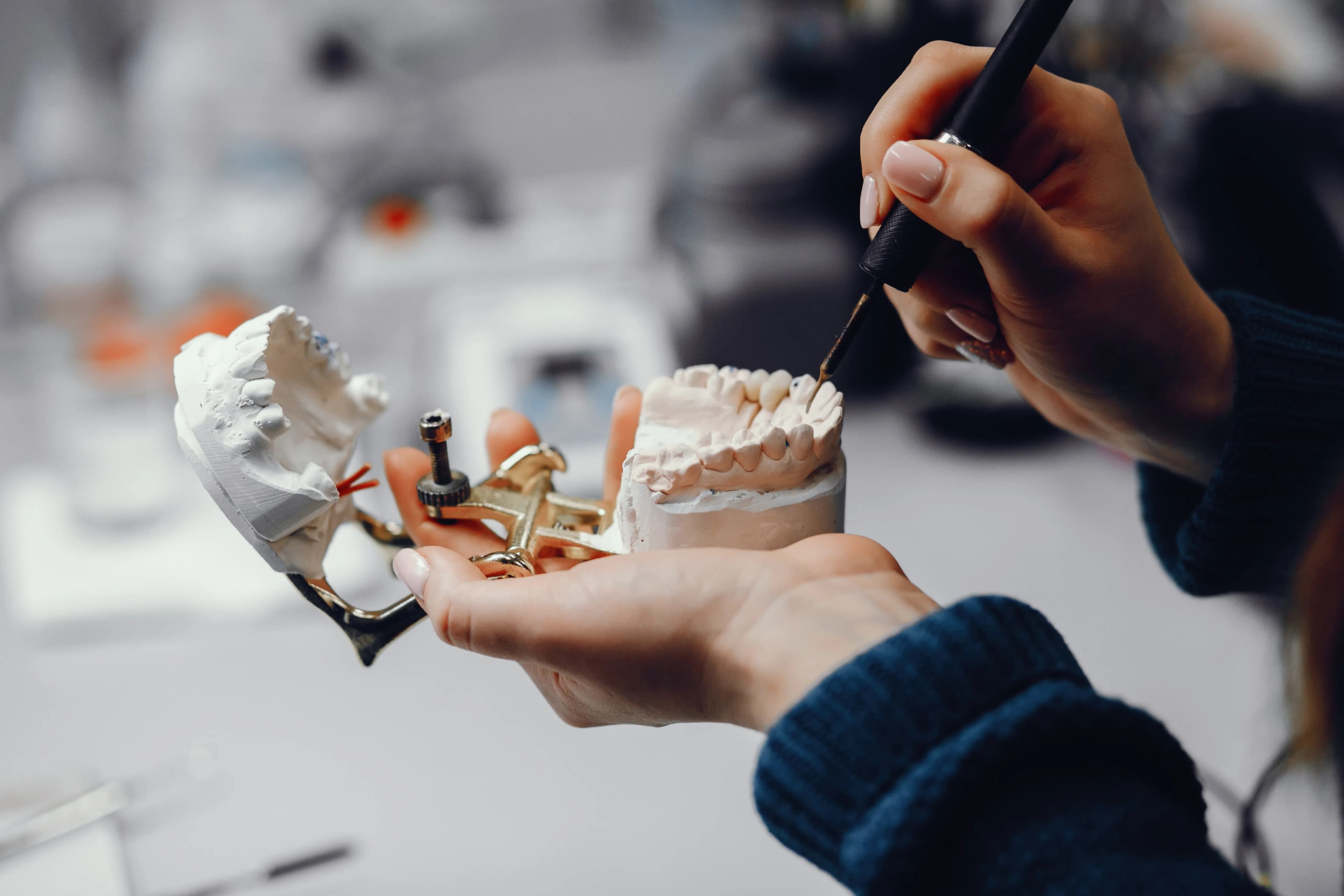 Dental Implants at SmileKraft Dental Jersey City