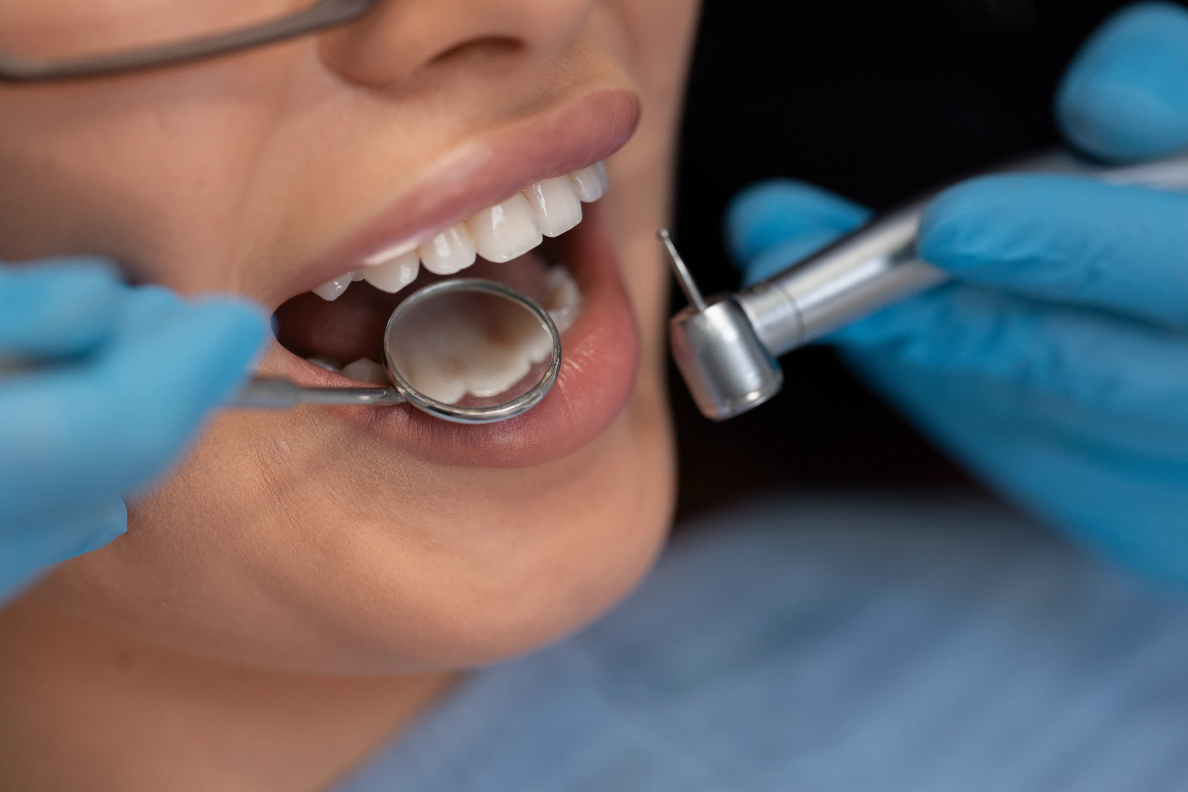 Endodontics at SmileKraft Dental Jersey City