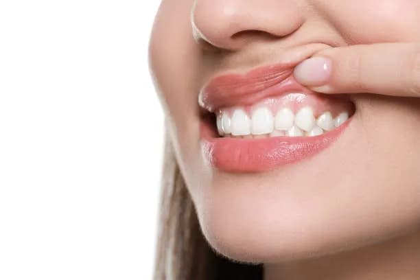 Perio Protect gum disease treatment at SmileKraft Dental Jersey City